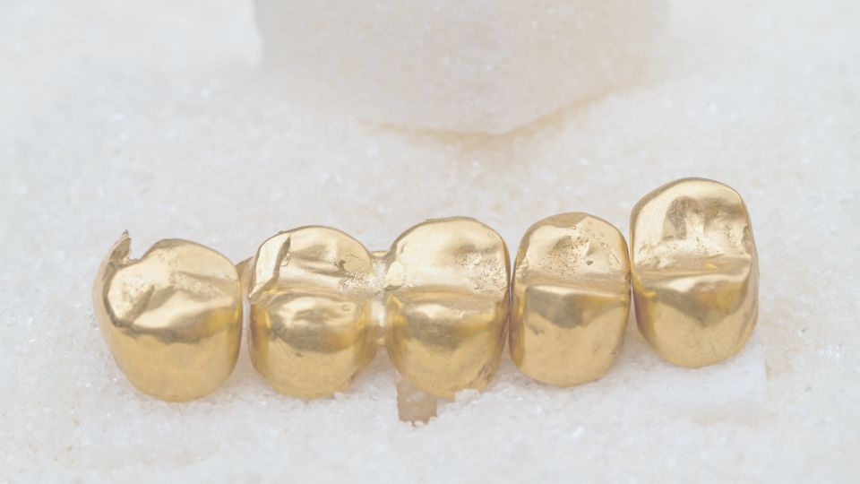 golden teeth